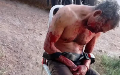 Un hombre fue detenido en Sarmiento tras agredir gravemente a su tío durante una discusión familiar