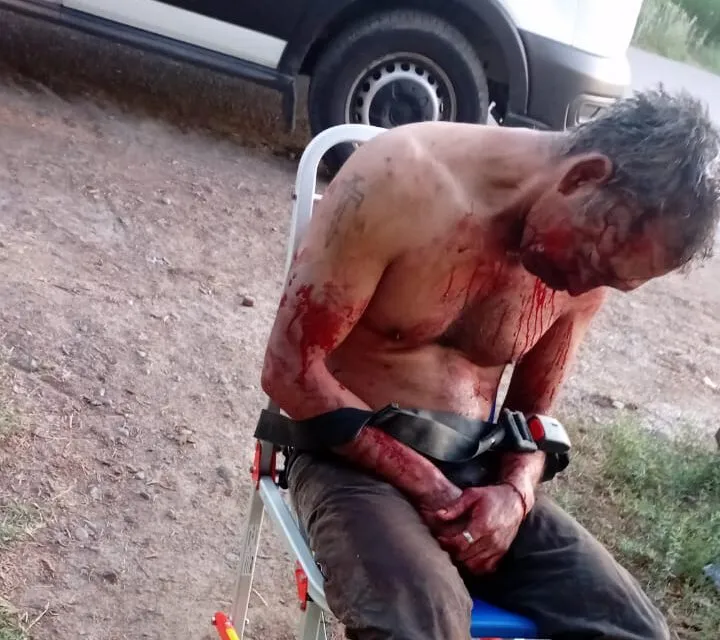 Un hombre fue detenido en Sarmiento tras agredir gravemente a su tío durante una discusión familiar