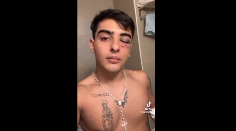 Tucumán: investigan una agresión grupal a un joven de 19 años a la salida de un boliche en Tafí del Valle