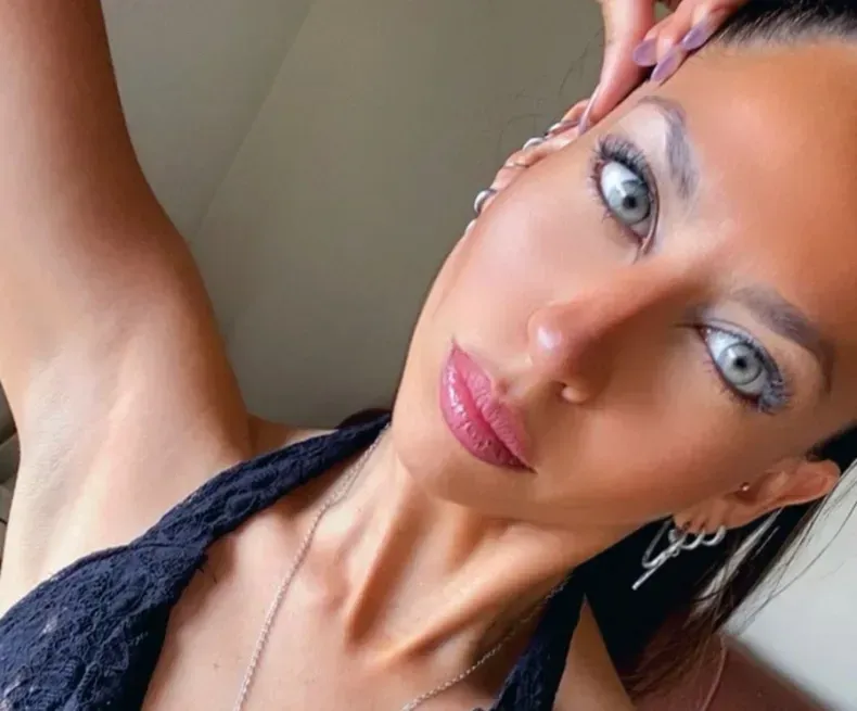 Dolor: falleció la joven que se había accidentado hace poco más de un mes en El Encón